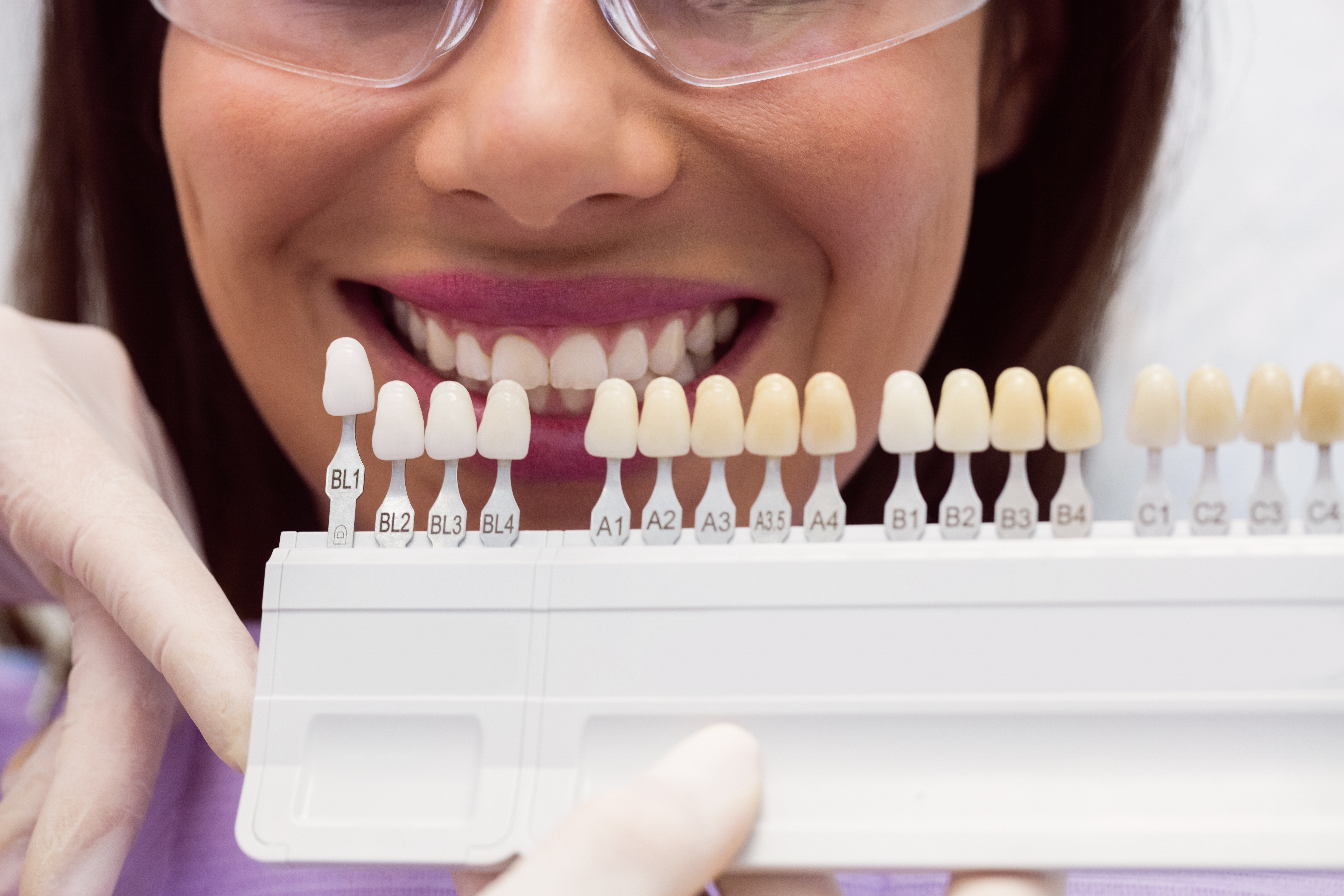 Aclaramiento Dental Cosmetico